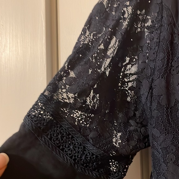 Suzanne Betro Cotton and Lace v-neck Dress - Picture 3 of 7